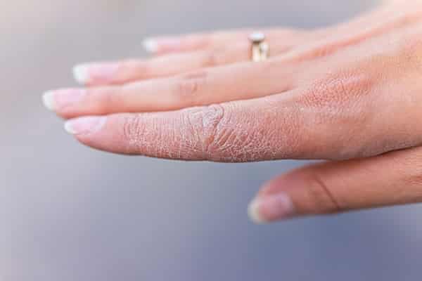 تصویر 1 از قیمت پماد ترک دست با کیفیت ارزان + خرید عمده